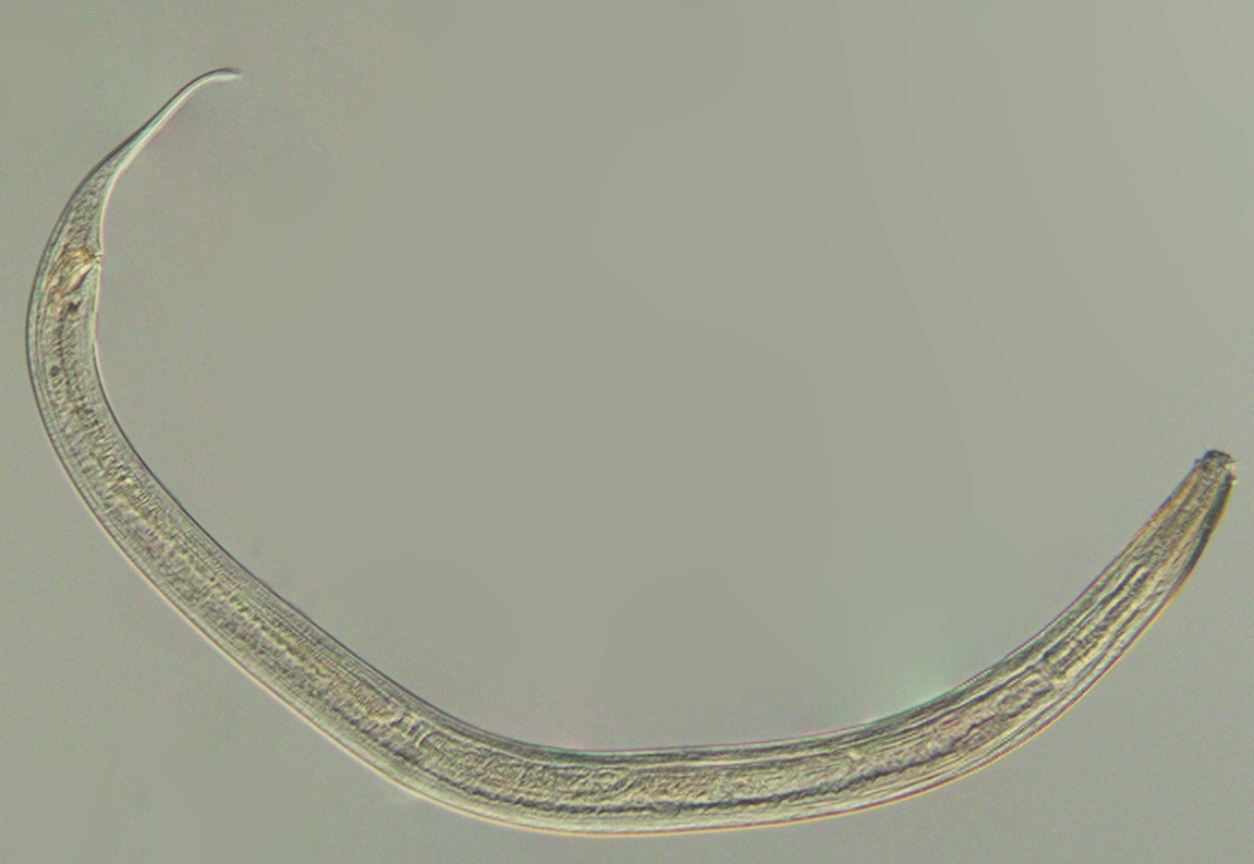 Представитель Семейства Cyatholaimidae